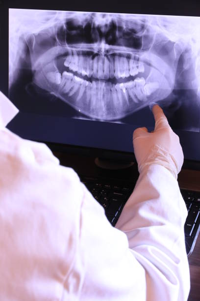Best Weekend Emergency Dentist in Avila Beach, CA